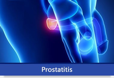 prostatis